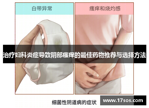 治疗妇科炎症导致阴部瘙痒的最佳药物推荐与选择方法
